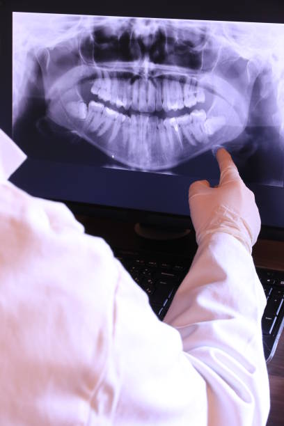 Best Dentist for Tooth Abscess  in Berry Hill, TN